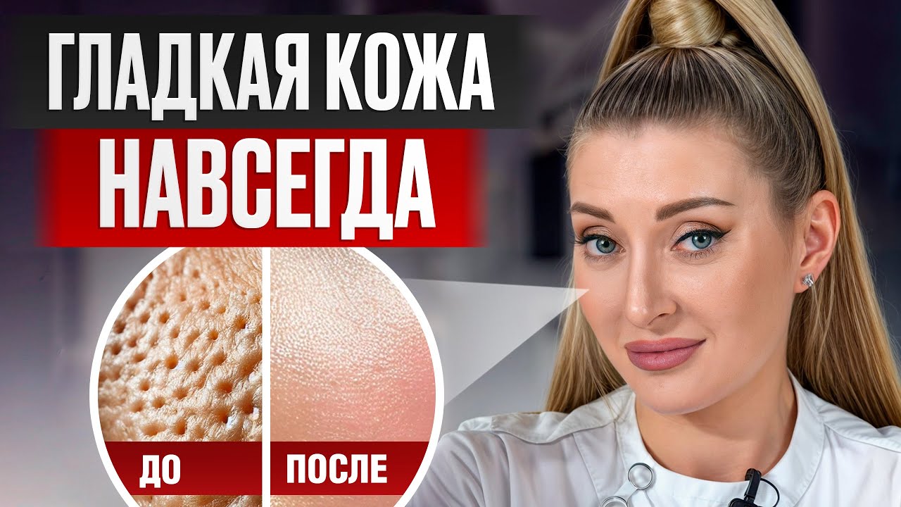 Как НАВСЕГДА сузить поры? / ЛУЧШИЕ средства для идеальной кожи