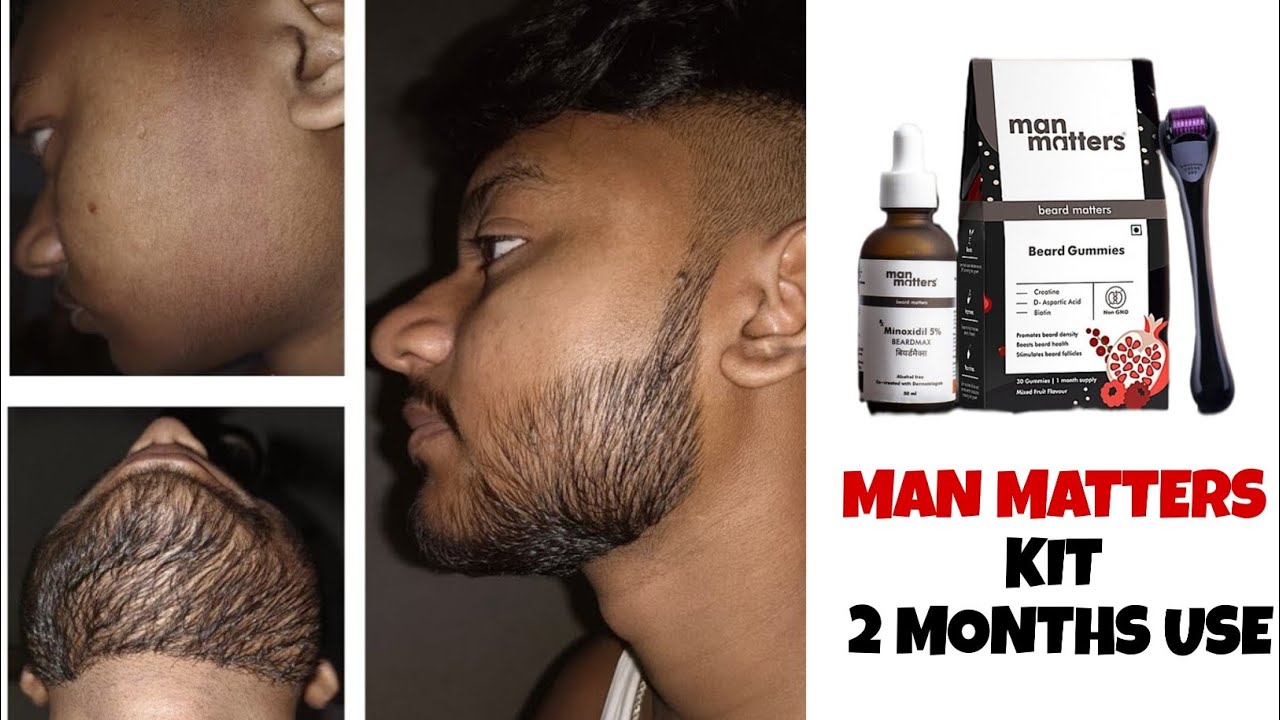 सिर्फ दो महीने में इस तरह दाढ़ी आ सकती हैं ? Man matters beard growth kit review | minoxidil beard 