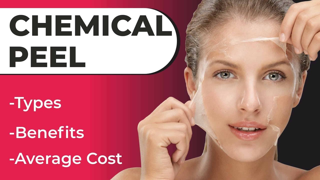 Peeling Treatment | Glycolic Acid peel for pigmentation and acne 