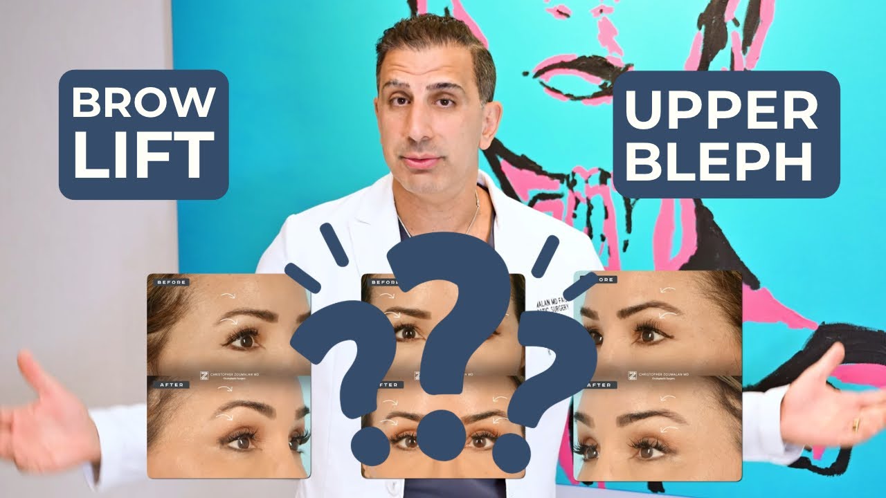 Brow Lift vs. Blepharoplasty: Which One Do You Need? | Dr. Zoumalan Explains