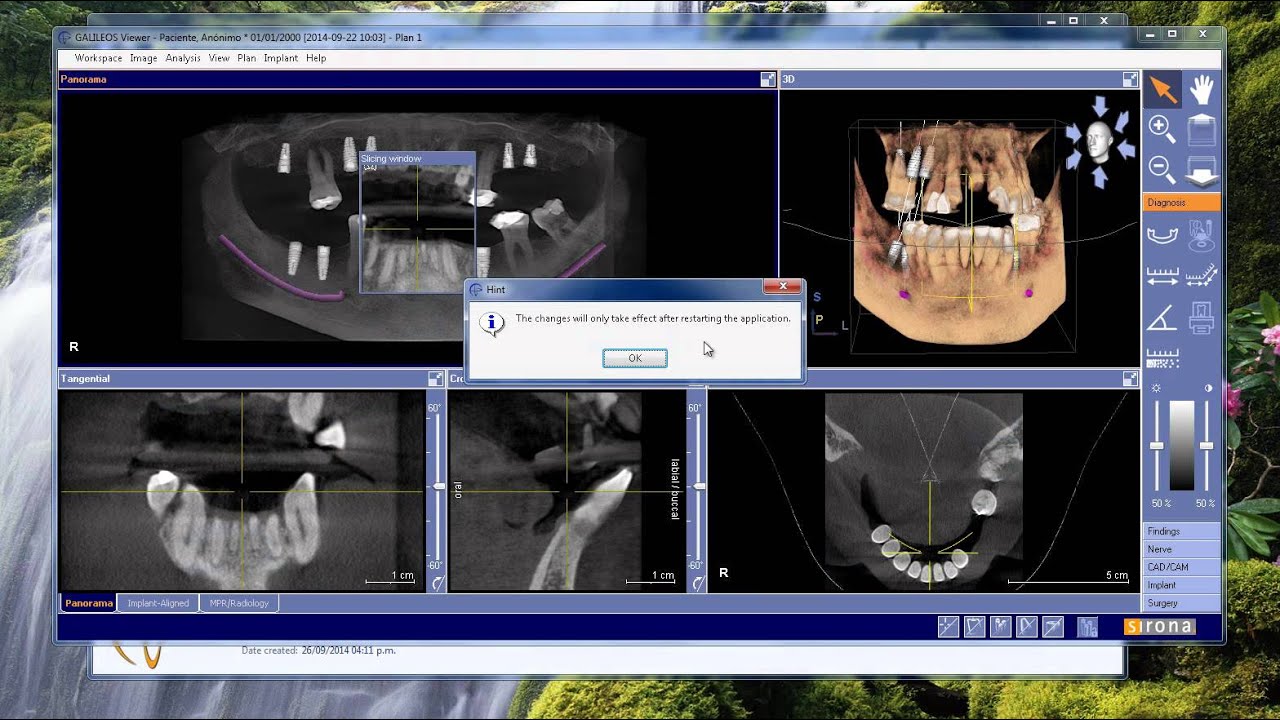 Instalacion de Software Galileos Viewer #CRD3D