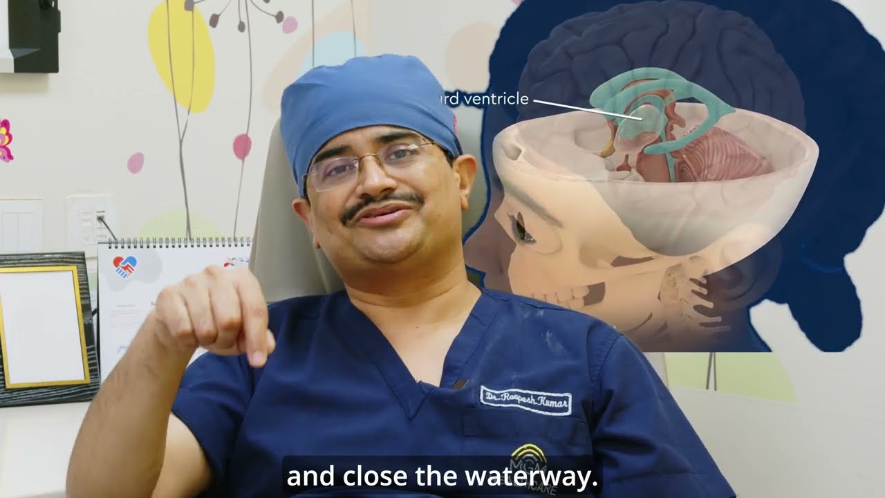 Craniopharyngioma ( Skullbase tumor) - Symptoms Dr.Roopesh Kumar