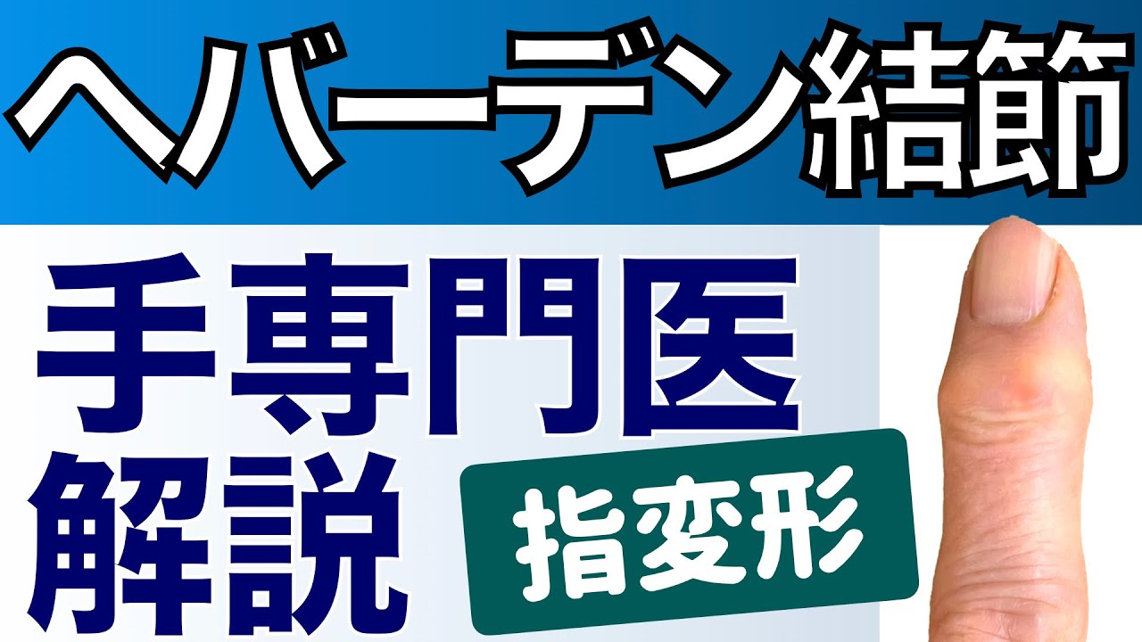 【手専門医解説】ヘバーデン結節　第一関節の変形