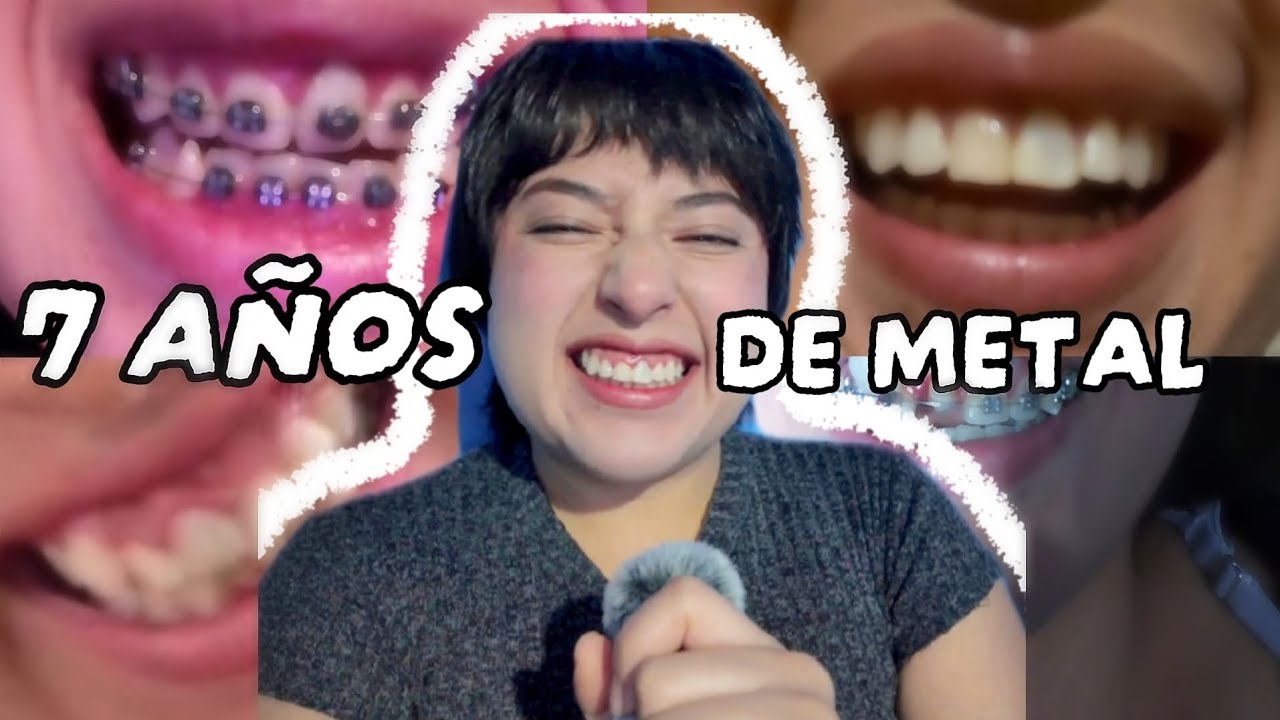 7 Años de Metal / Bye , Bye Brackets 🦷