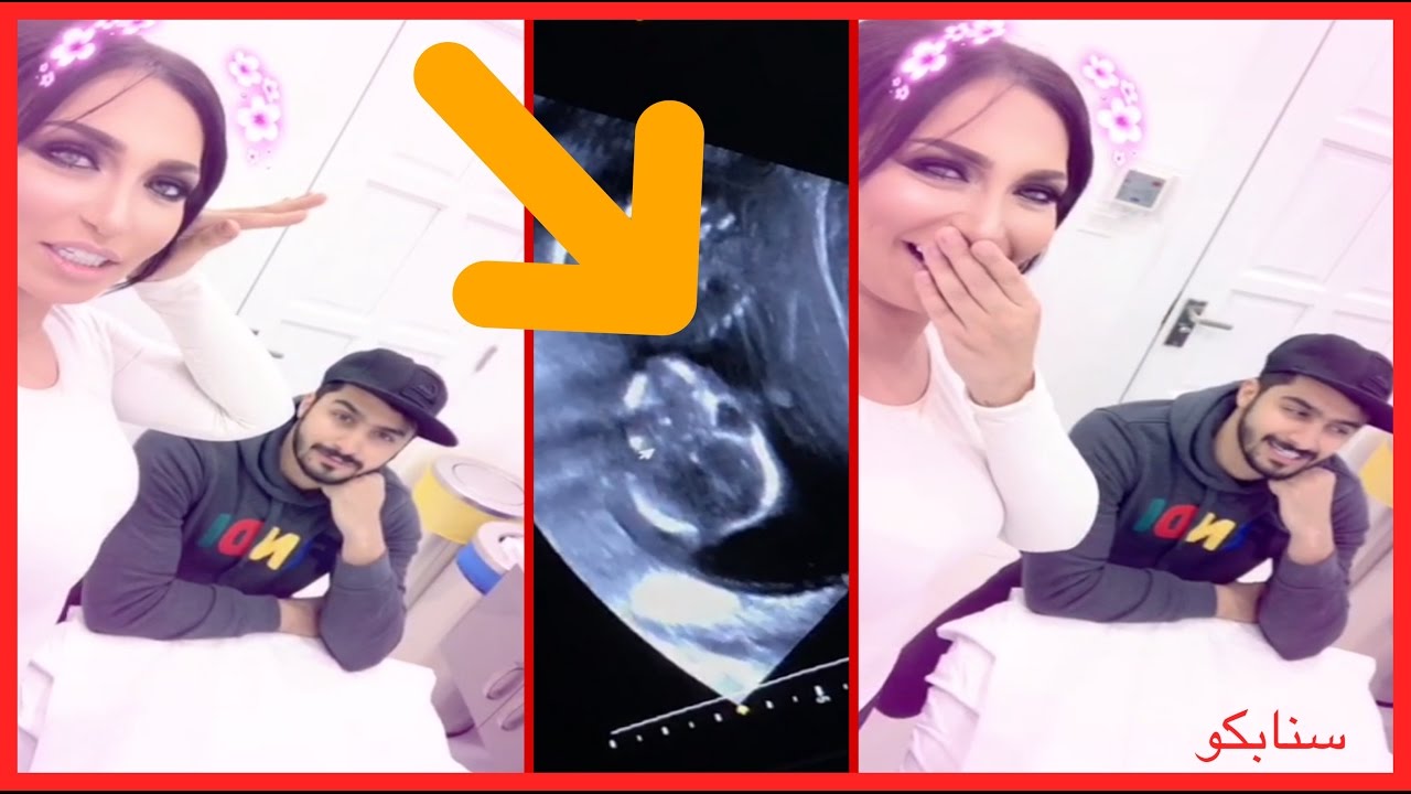 شاهد ردة فعل د.خلود وامين عند كشفهم لجنسية طفلهم 