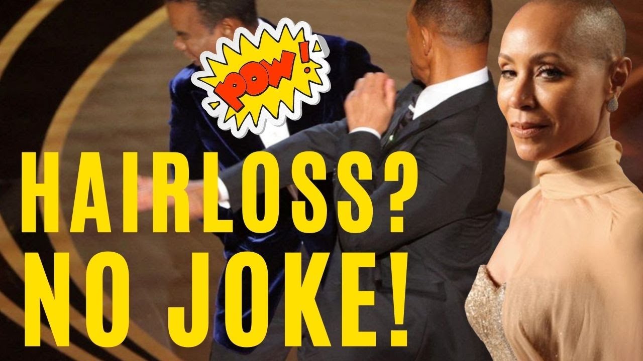 A Slap In The Face For Women With Hair Loss!