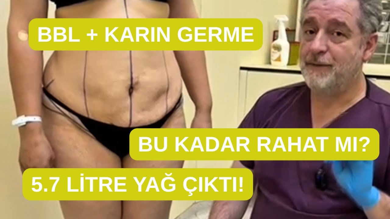 Karın Germe + BBL Aynı Anda | 2 Doğum Sonrası Muhteşem Değişim