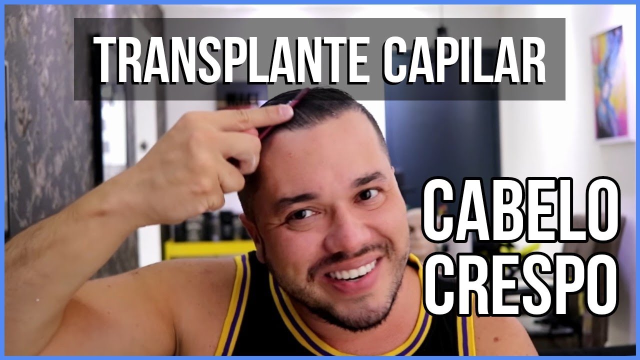 Cabelo Crespo Após o Transplante Capilar? Botox?