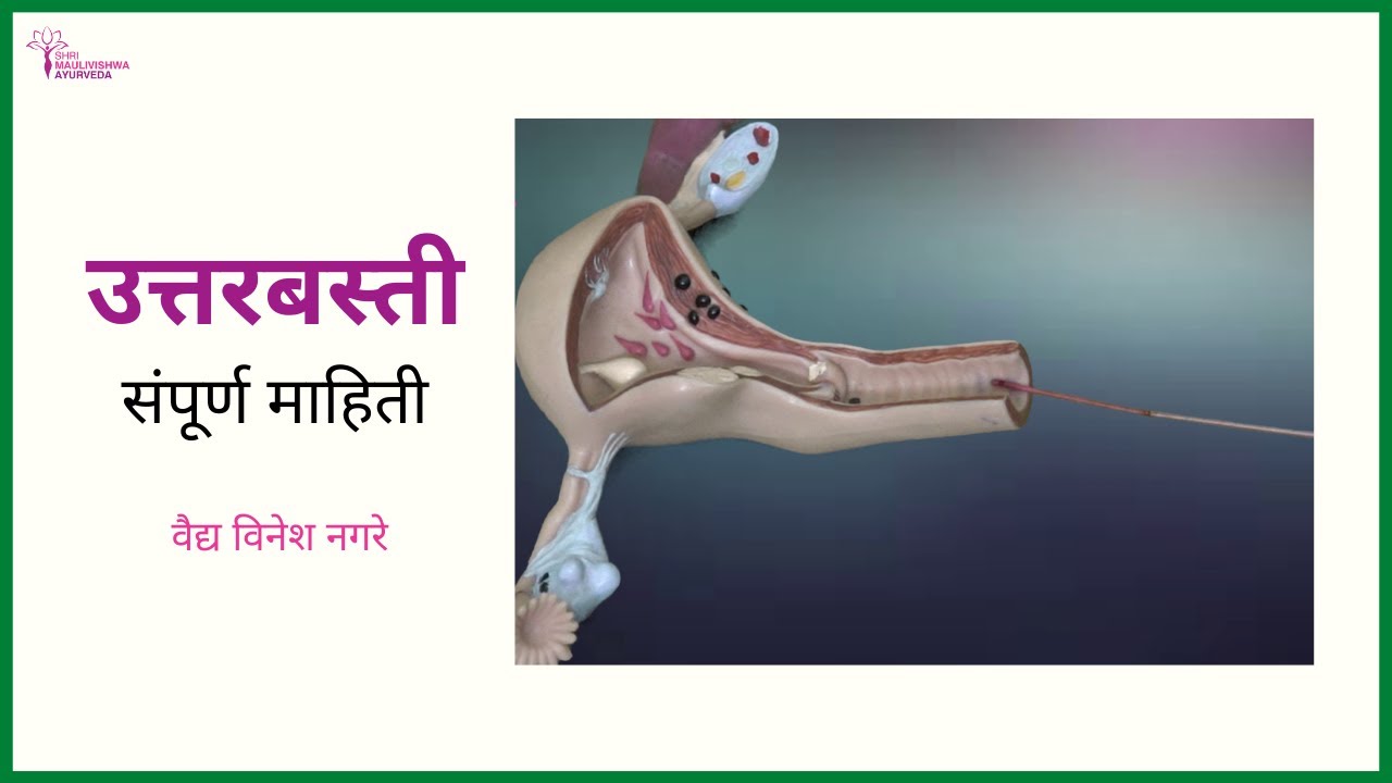 उत्तरबस्ती संपूर्ण माहिती | Uttar Basti Complete Information | वैद्य विनेश नगरे