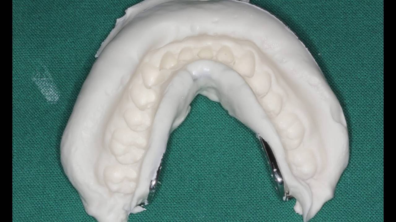 How to make alginate impression on dentate patient?