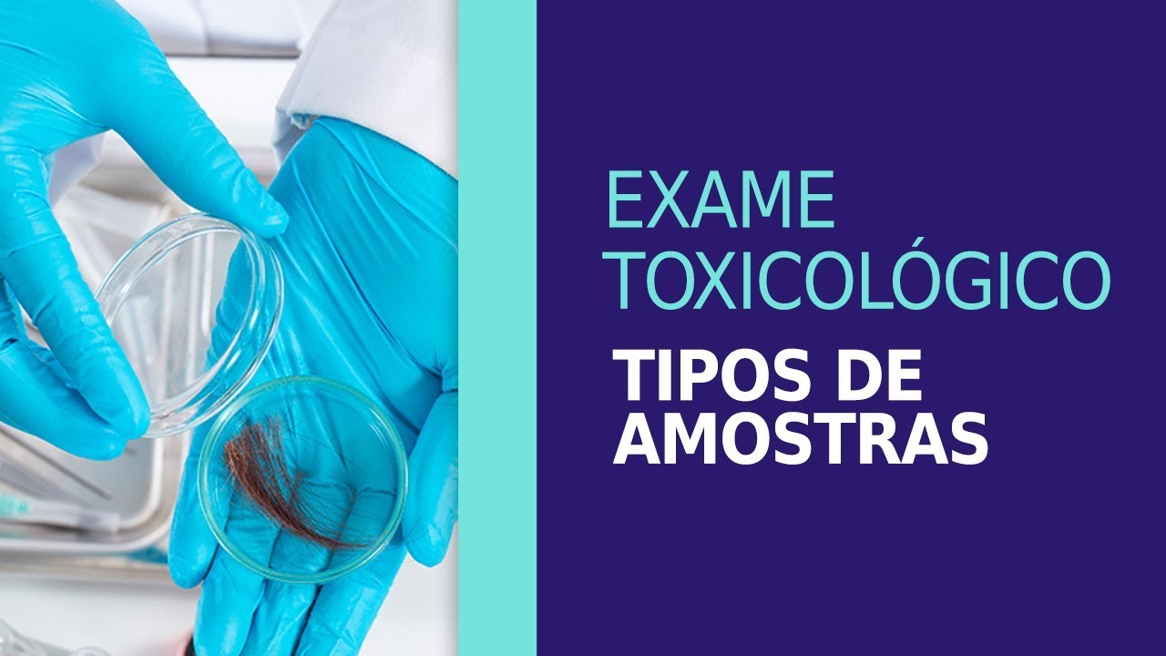 Como &eacute; feito o exame toxicol&oacute;gico? - Tipos de amostras