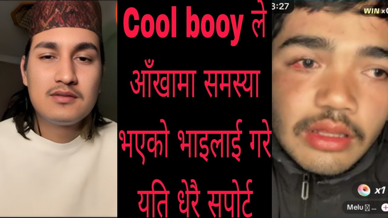 Cool booy ले आँखामा समस्या भएको भाइलाई फुल सपोर्ट गरे।