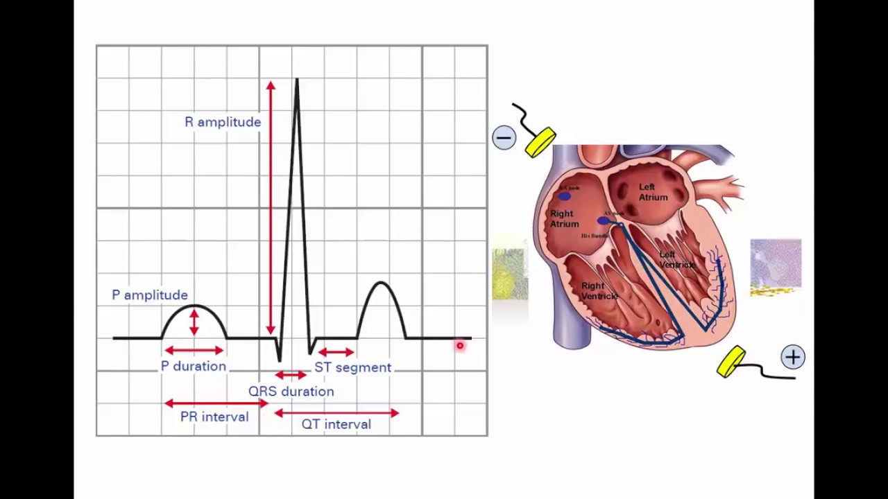 How to use PR and QT intervals to identify P and T waves on ECGs of dogs and cats