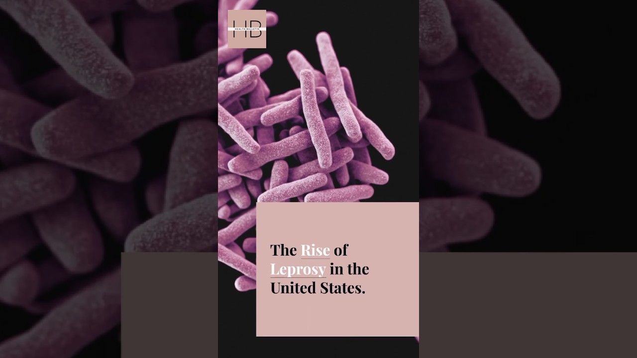 Leprosy Outbreak | The Terrifying Secrets Unraveled - What You Need to Know NOW !#shorts #usa