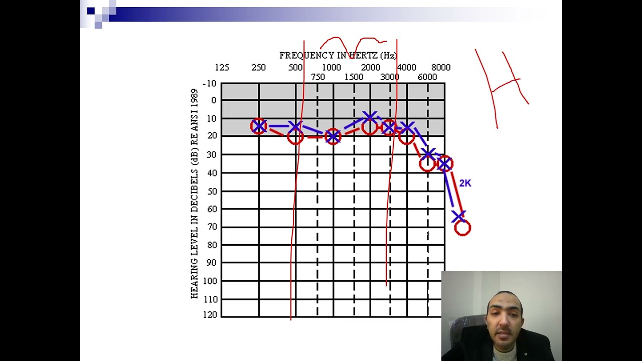Inner ear 2 dr- ahmed hassan sweed