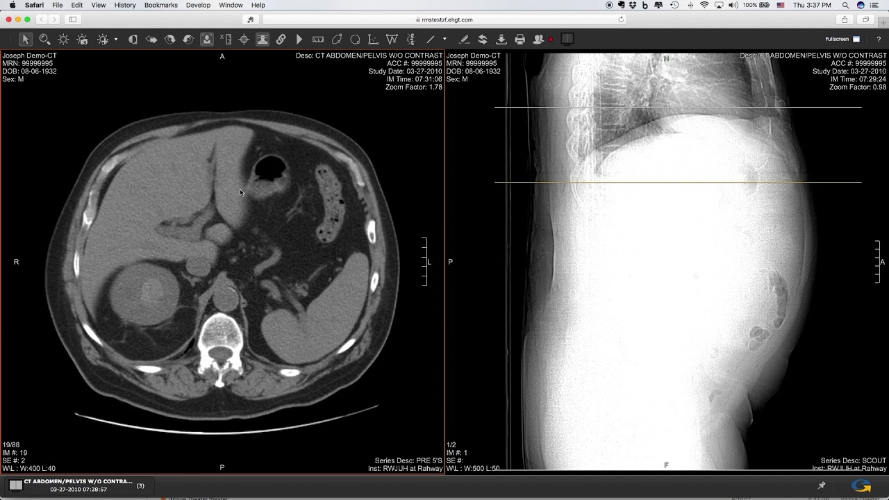 myBaystateHealth Patient Portal - My Radiology Results Image Viewer