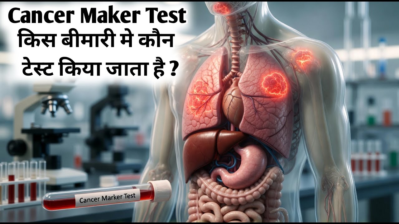 Cancer marker test | tumor marker test in hindi