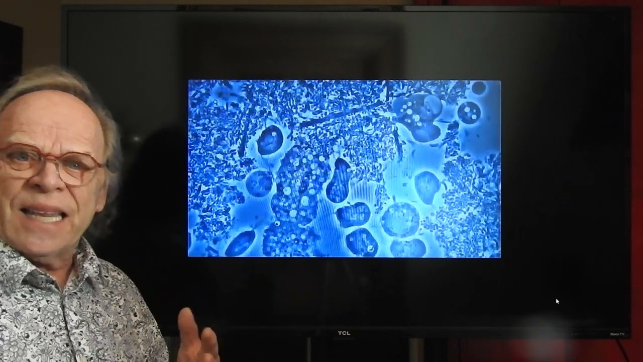 Guérir la parodontite en éliminant vos parasites. Dr Mark Bonner live cure gum disease