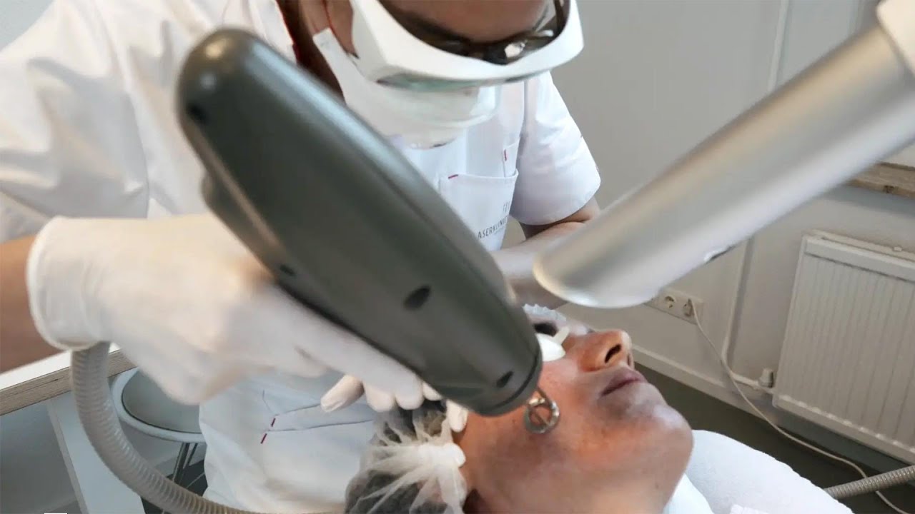 Fractional laserbehandeling voor huidverbetering of acnelittekens