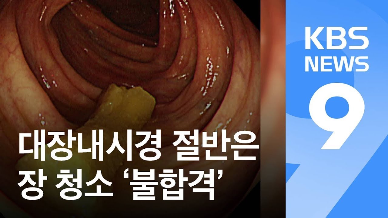 대장내시경 절반은 장 청소 &lsquo;불합격&rsquo; / KBS뉴스(News)