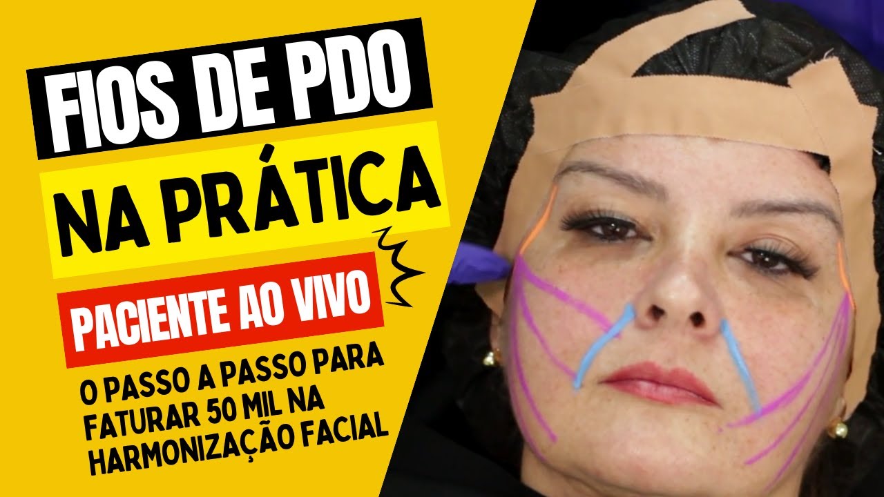Aprenda tudo sobre Fios de PDO na Prática! Procedimento AO VIVO
