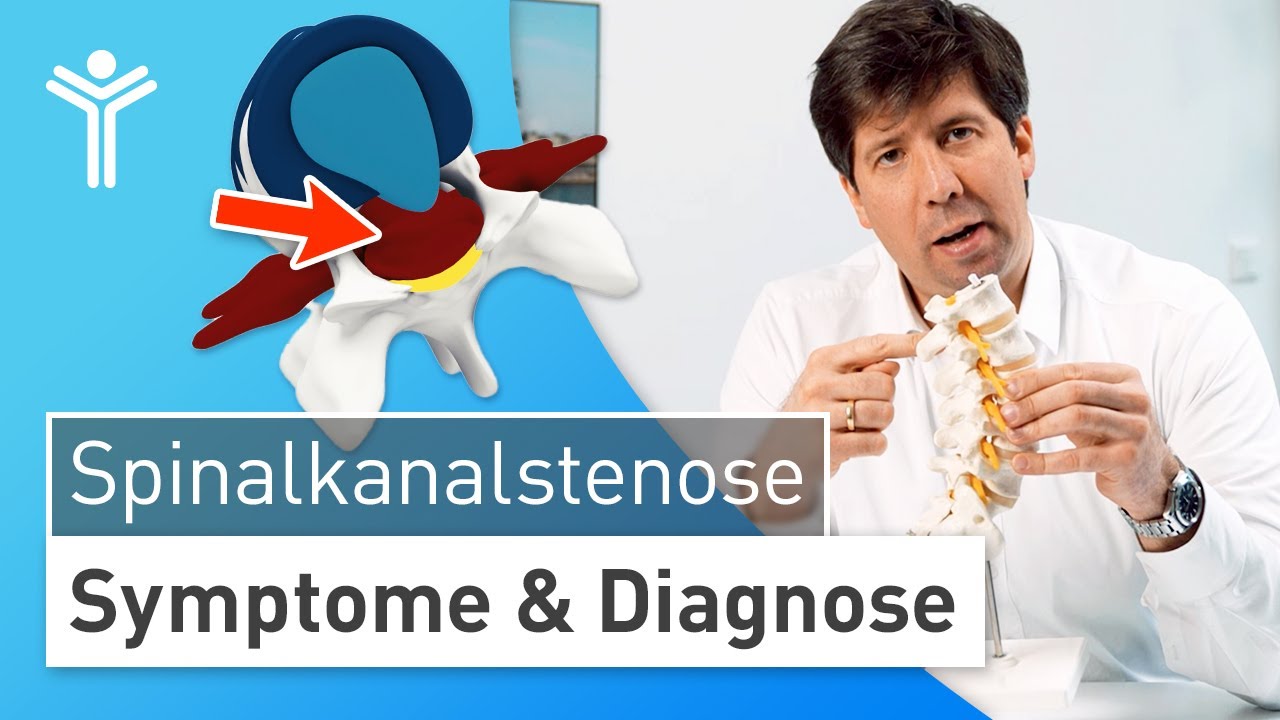 Spinalkanalstenose: R&uuml;cken- und Beinschmerzen durch Verengung des Wirbelkanals der LWS