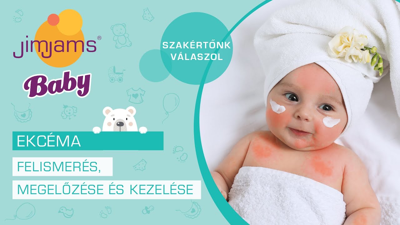 Csecsemőkori ekcéma - felismerés, megelőzés és kezelés