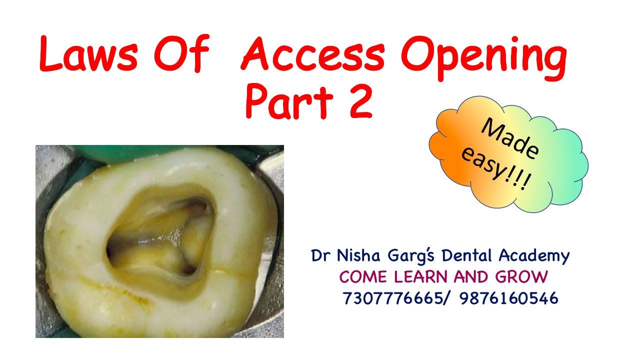 LAWS OF ACCESS CAVITY PREPARATION - PART 2 | DR NISHA GARG'S DENTAL ACADEMY