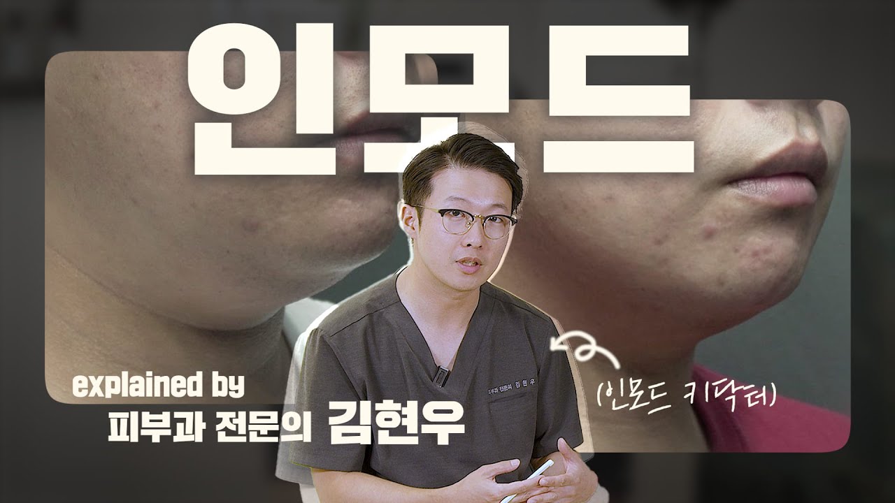 인모드 총정리, 이 한 편만 보시면 됩니다. (feat. 매일 인모드 하는 의사)