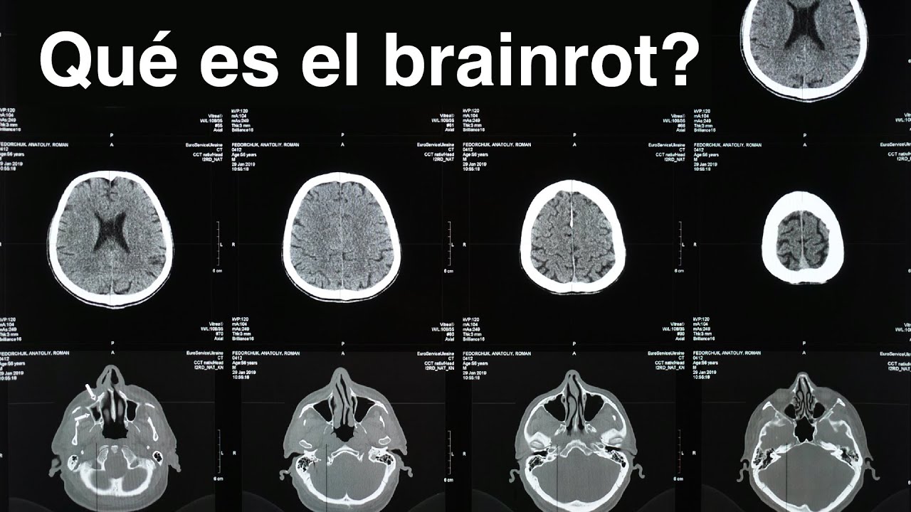 La trampa del scroll infinito | Brain rot