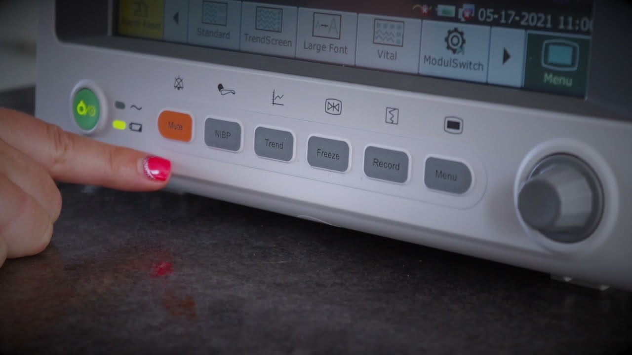 Edan IM60 Vet Multi-Parameter Detailer - Vet Direct