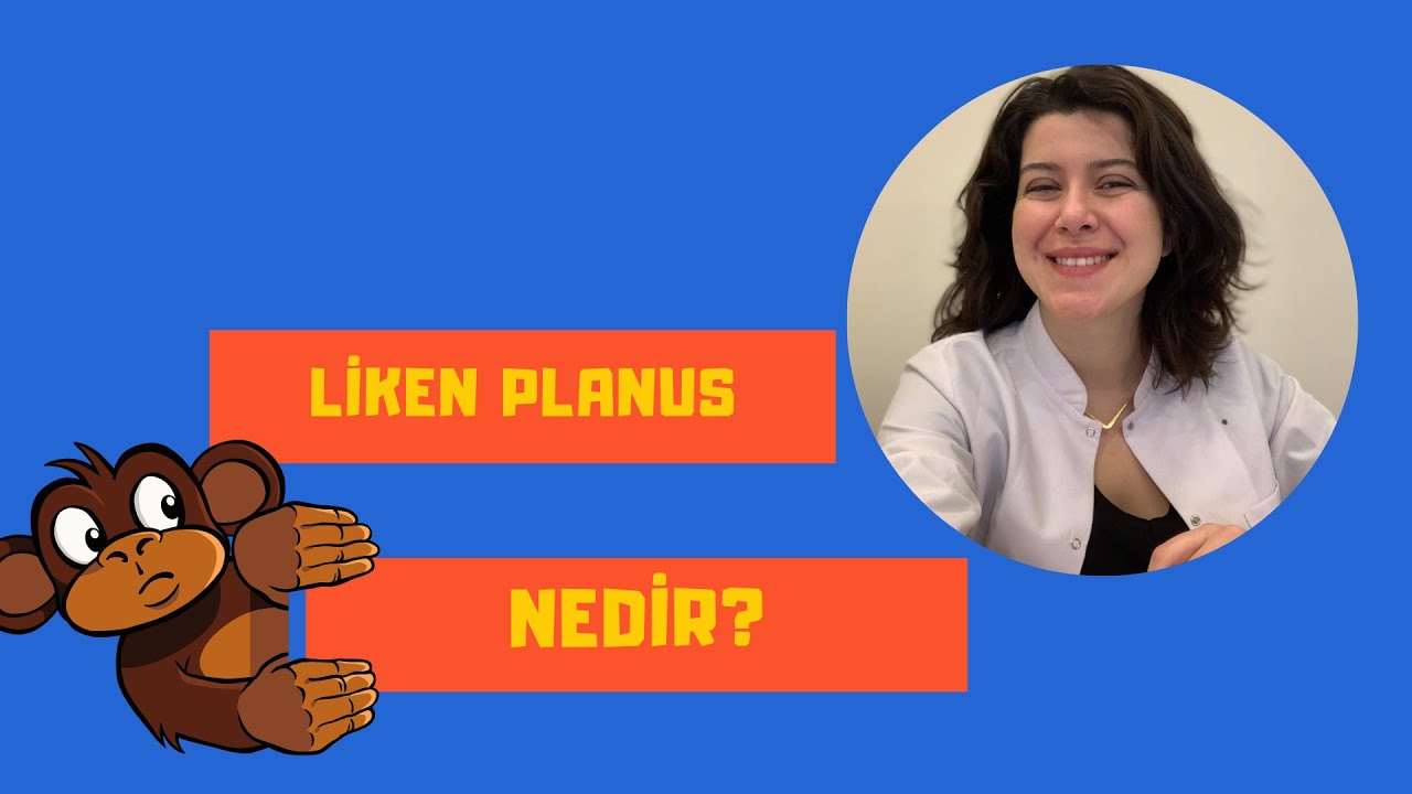 Liken planus