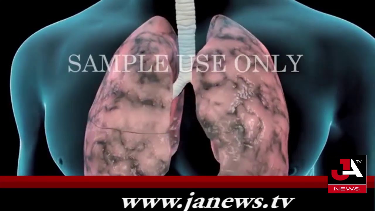 What is in a cigarette? | Smoking cause DEATH | Smoking and Lung disease | Lung Cancer | JA News TV