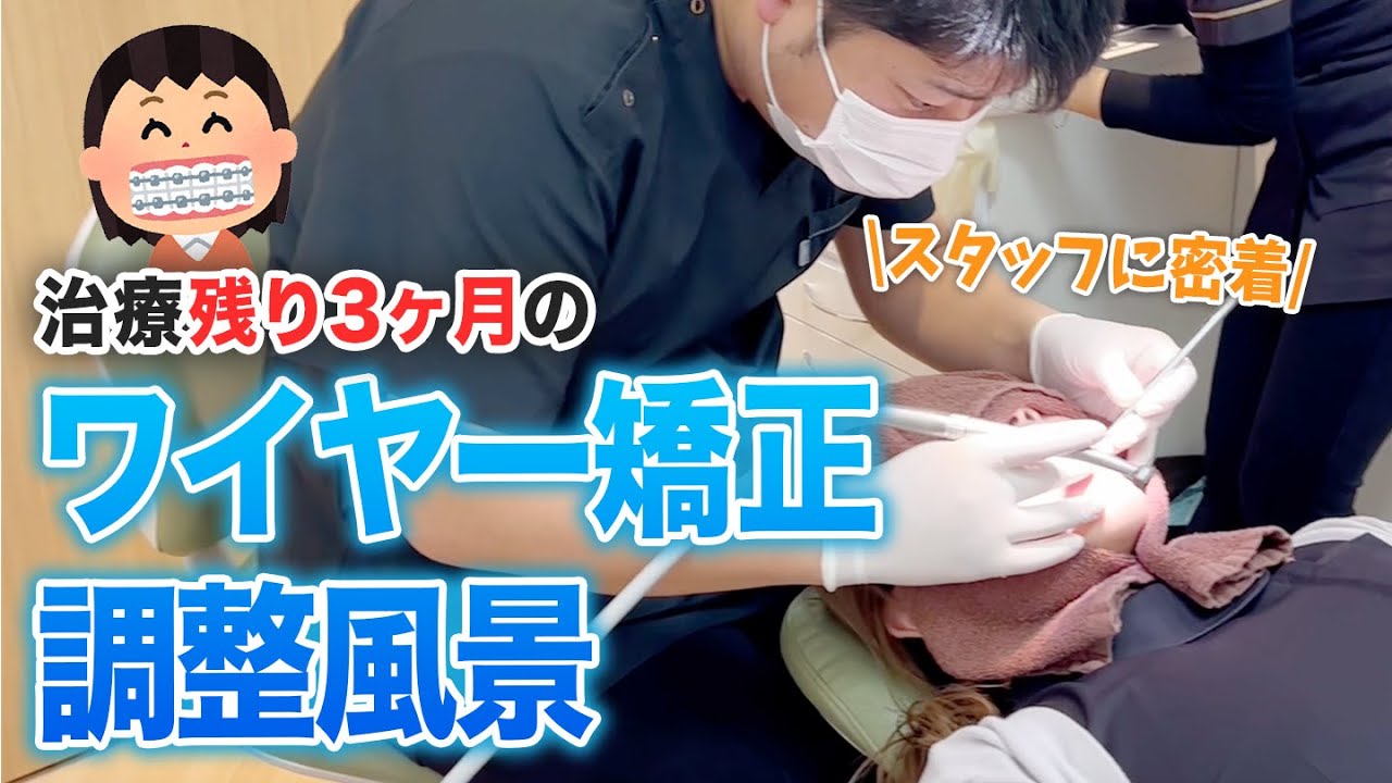 【スタッフに密着】治療期間残りわずかのワイヤー矯正調整風景！【名古屋茶屋歯科・矯正歯科】