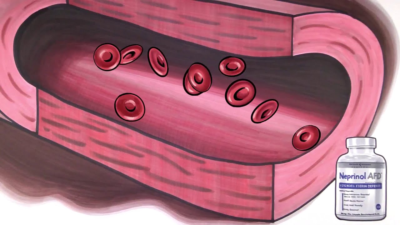 Neprinol Enzymes for normal (Fibrin & Clotting)