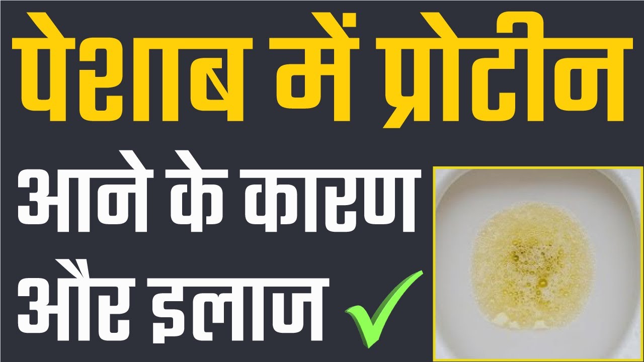 पेशाब में प्रोटीन आने के कारण और इलाज | Protein Loss in Urine
