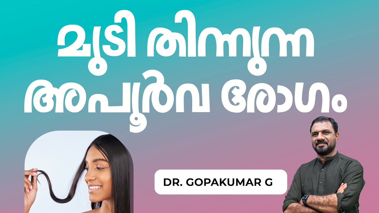 മുടി തിന്നുന്നഅപൂർവ രോഗം |  Dr Gopakumar G