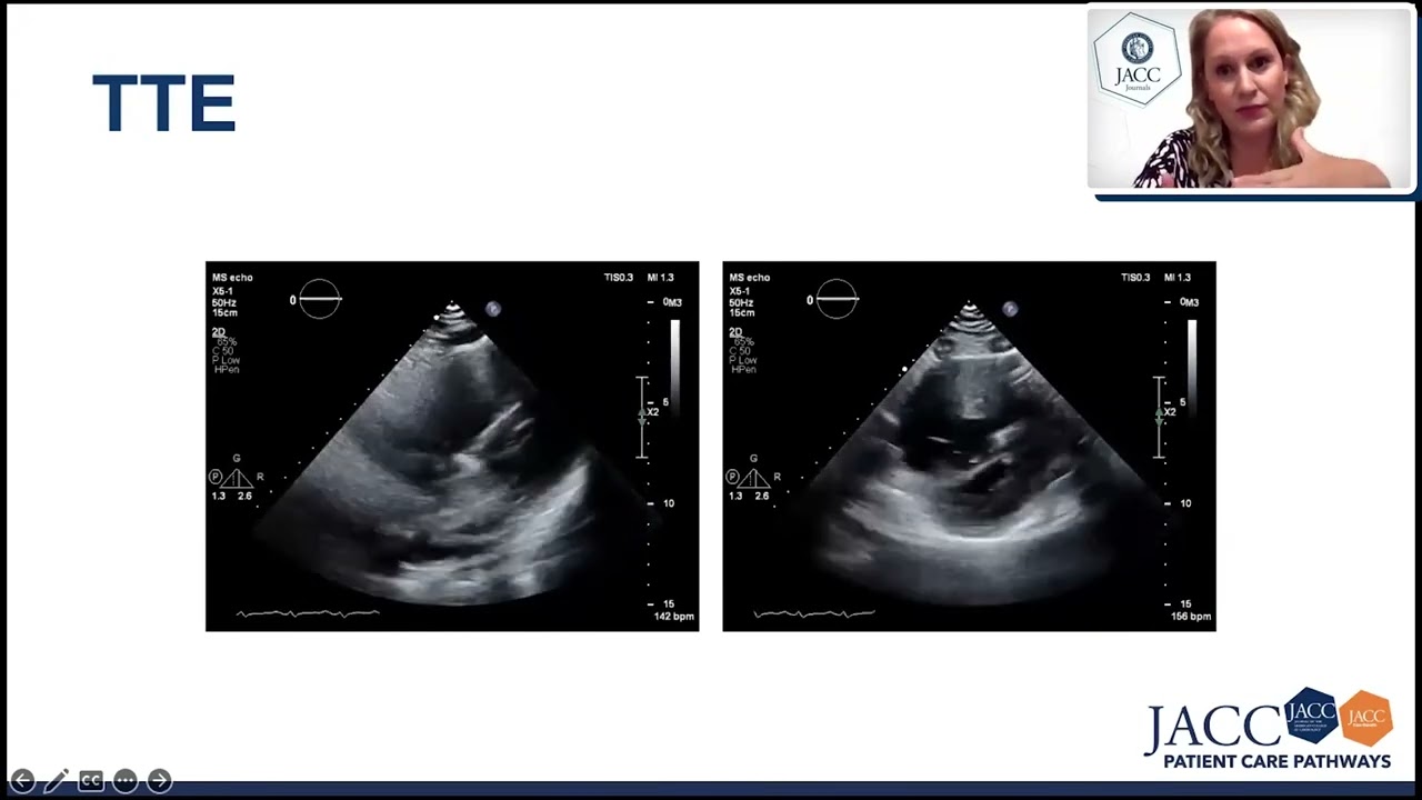 Labor & Delivery: Pressure vs Volume Overload - JACC PCP | Sudden Respiratory Distress in Pregnancy