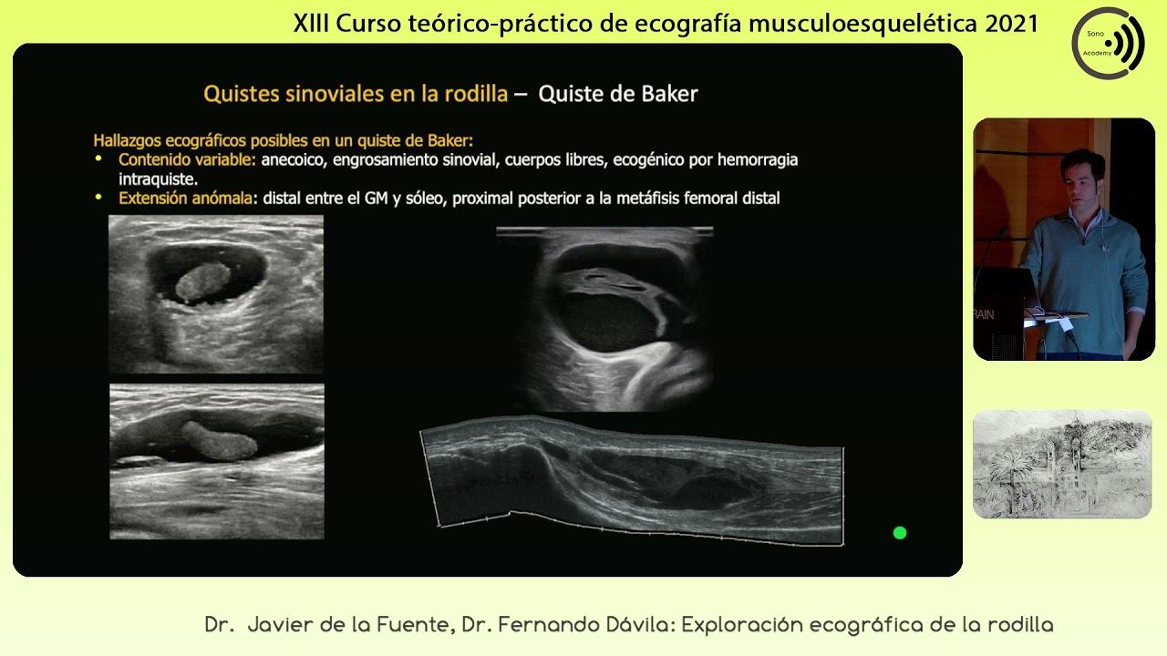 2021  exploracion ecográfica de la rodilla  Fernando Dávila