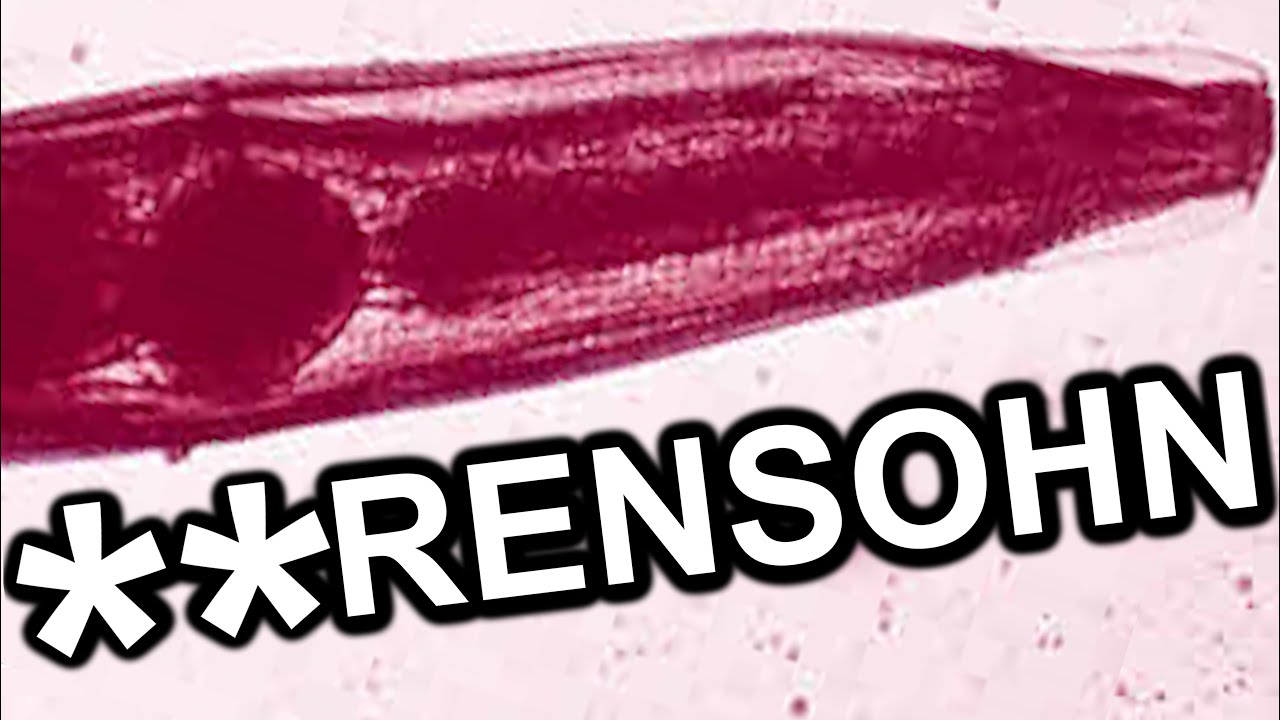 Madenwürmer die **rensöhne