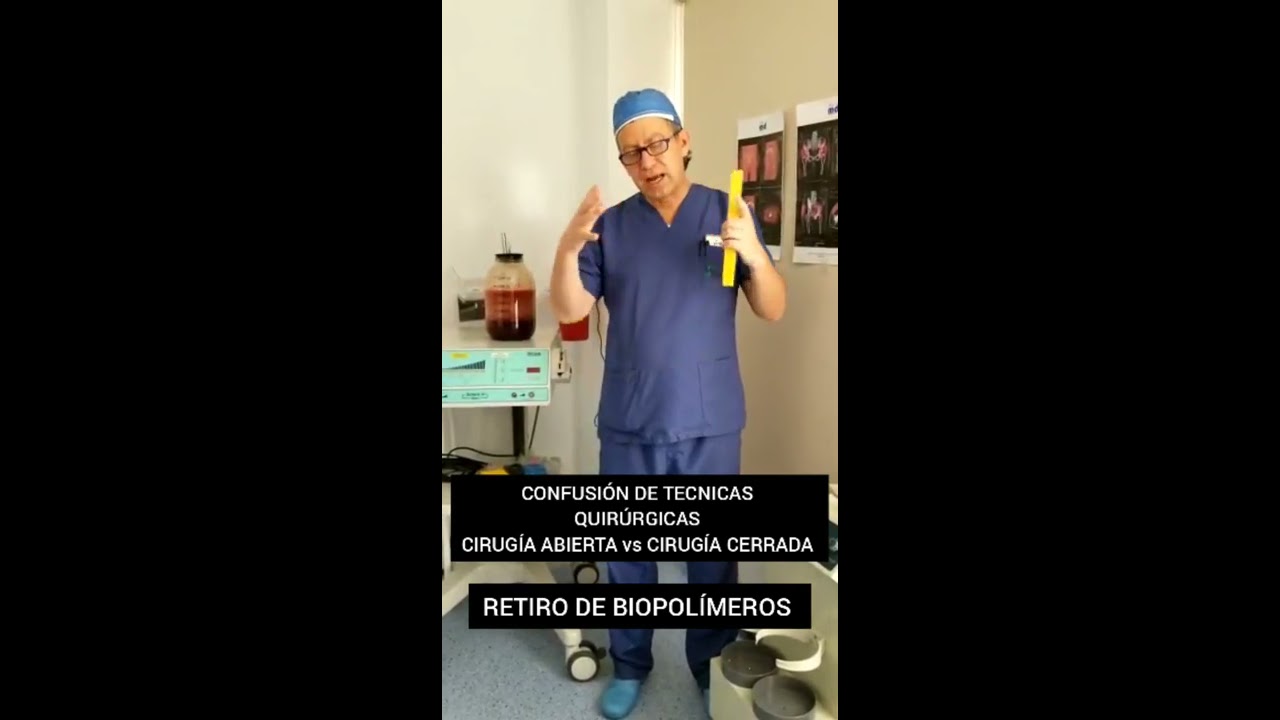 Cirugia abierta o cerrada retiro de silicona biopolimeros