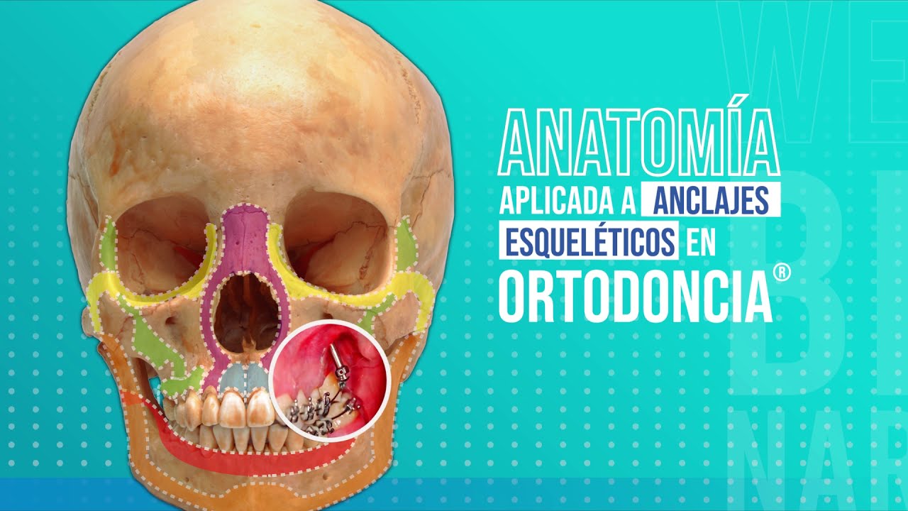 12 claves del éxito para la aplicación de mini anclajes