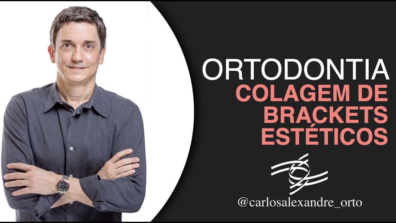 Colagem de brackets estéticos com posicionadores