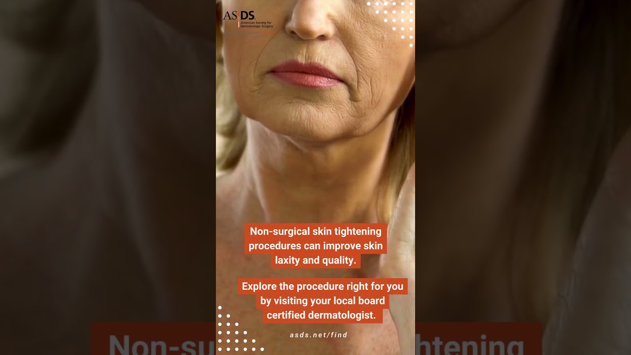 Non-surgical Skin Tightening Procedures