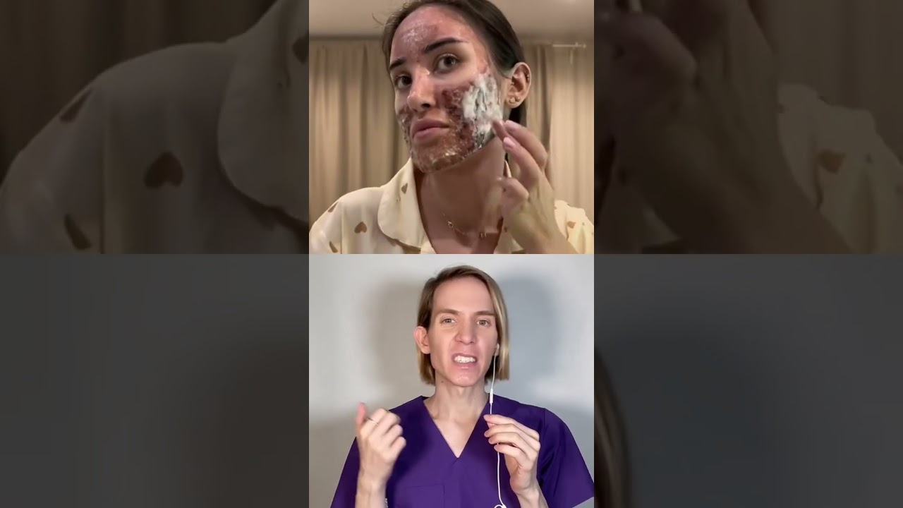 ¿Se harían este tipo de Peeling? 