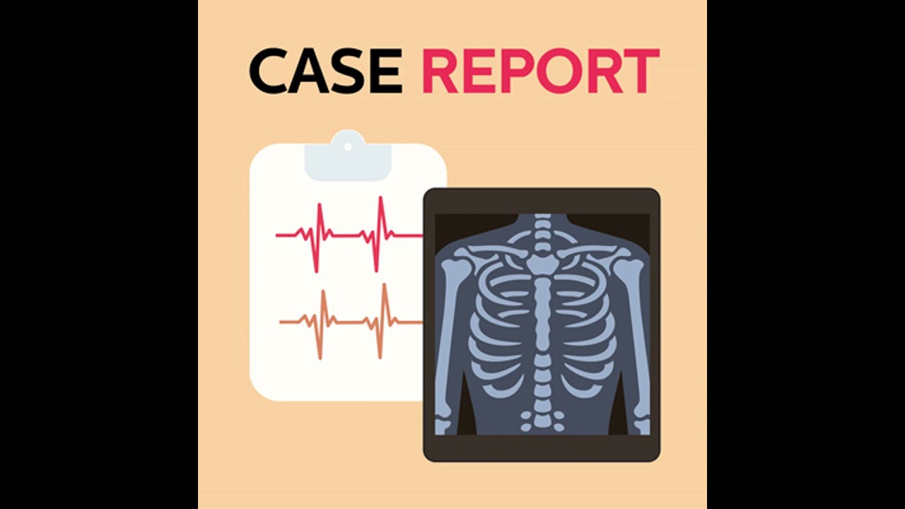 [Case Report] 62yo undergoing procedure for a lung nodule