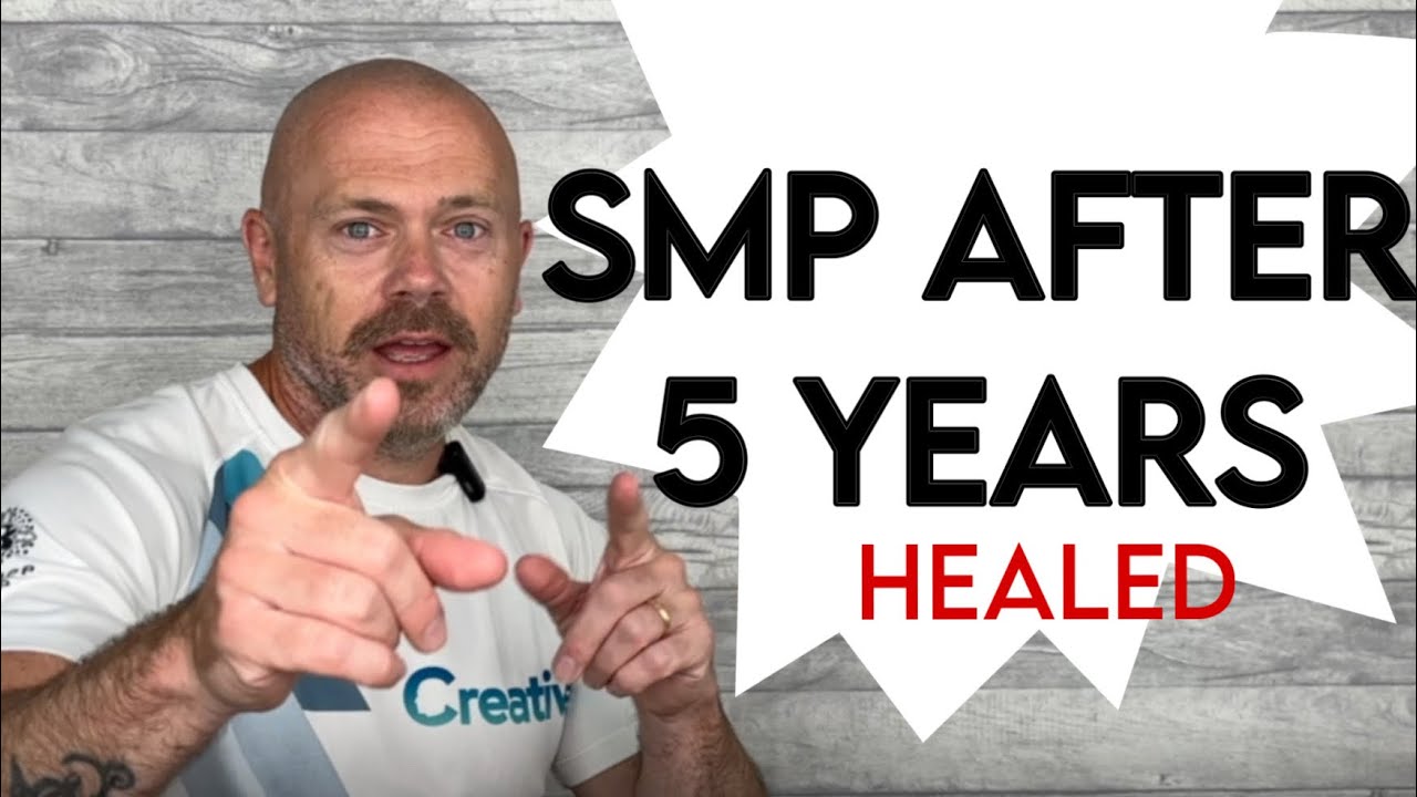 Real Healed SMP Results part2 | After 5 YEARS Creative Scalps