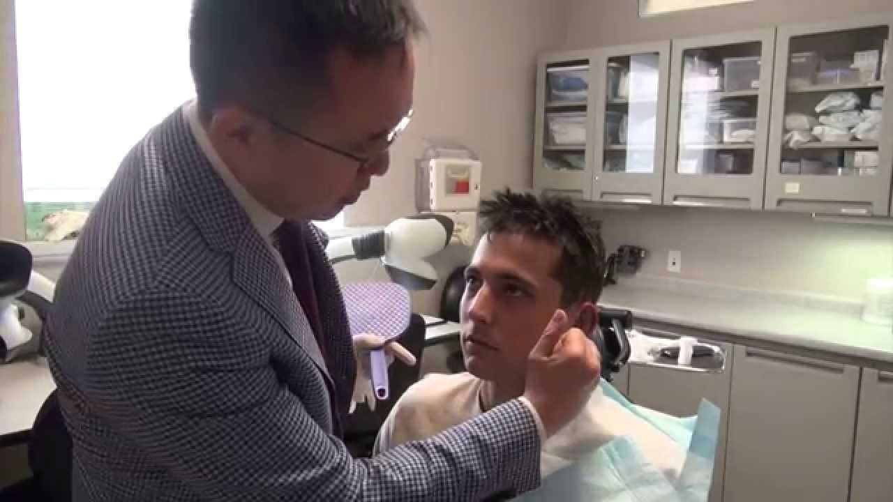 Unilateral (One-Sided) Otoplasty Cosmetic Ear Pinning