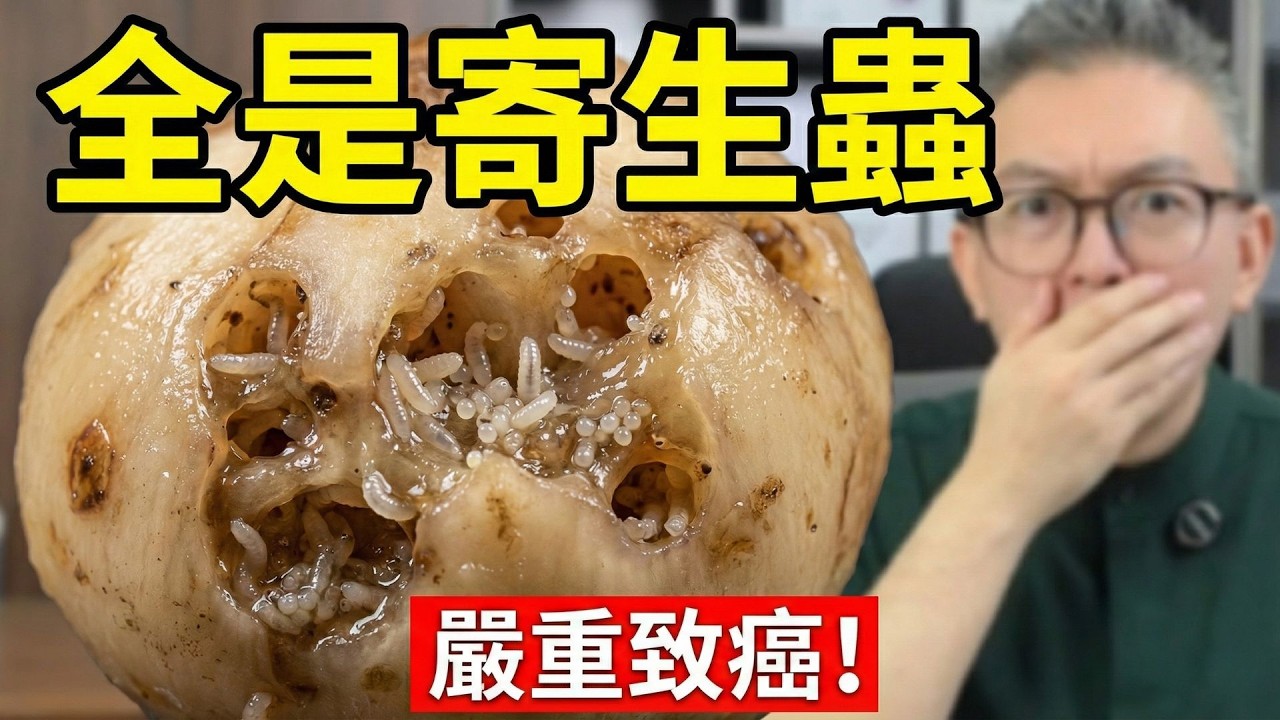 寄生蟲上腦？醫生點名5種街市美食全是蟲！鹽水殺不死，食錯恐致腦膜炎、膽管癌
