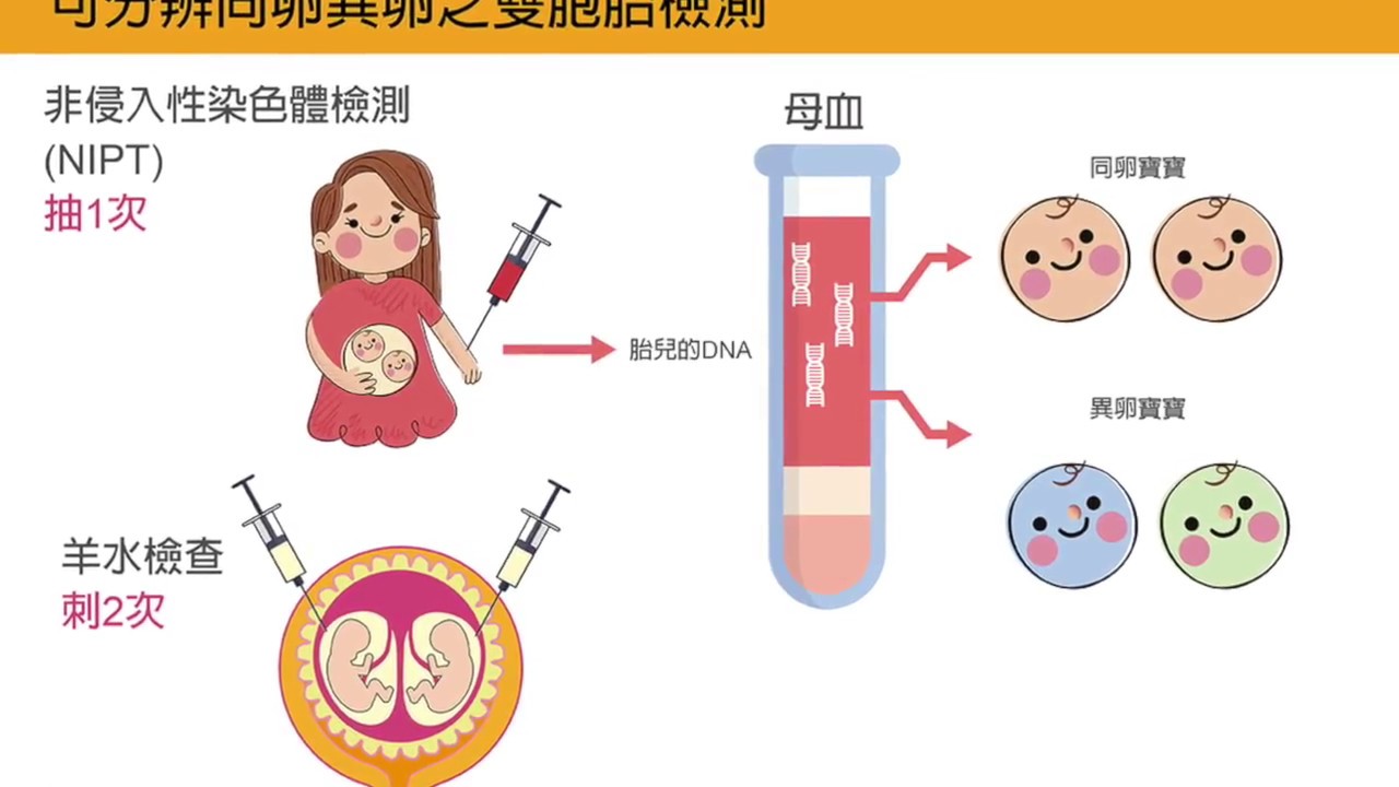 【訊聯線上媽媽教室】常見的同卵雙胞胎併發症-第四集